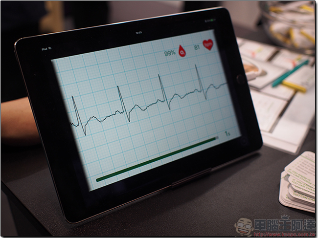 [ MWC 2017 ] WIWE ，用兩隻大拇指就能掌握健康數據 - 電腦王阿達