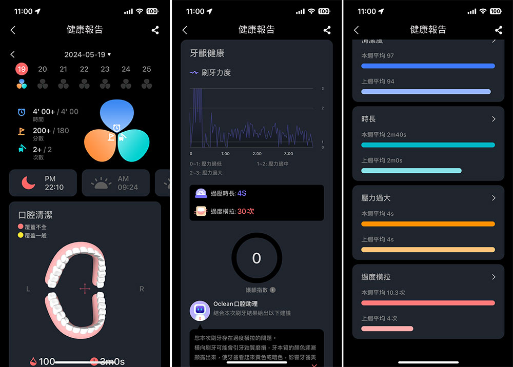 Oclean X Ultra WiFi 智慧電動牙刷開箱實測：骨傳導 AI 語音指導正確潔牙力度與區域，全齒清潔不漏刷 - 電腦王阿達