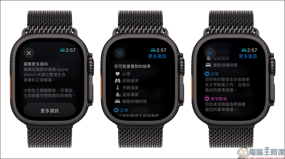 多名 Apple Watch 用戶表示「生命徵象」應用幫助自己提前檢測到疾病（同場加映：watch OS 11.1 預計加入睡眠呼吸中止症通知功能） - 電腦王阿達